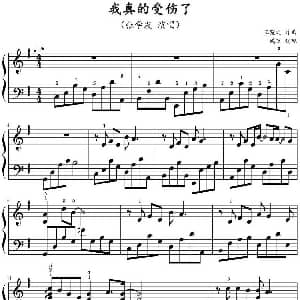 我真的受伤了 钢琴谱 王菀之作曲 鸠玖